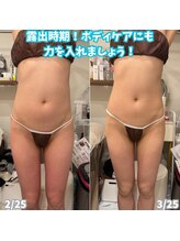 ビアル(VIALU)/骨盤底筋マシーンでヒップアップ