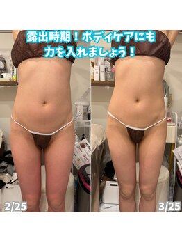 ビアル(VIALU)/骨盤底筋マシーンでヒップアップ