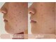 エーサロン(A-Salon)の写真