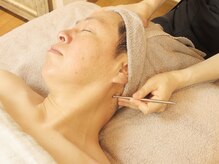 クランシュプール恵比寿鍼灸院/[メンズ美容鍼灸/恵比寿]