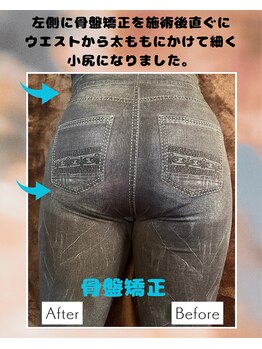 チャイディー(Chai Dee)/骨盤矯正