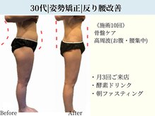 京都フォーエイチ(京都4H)/姿勢矯正|骨盤美人|美姿勢