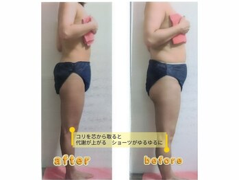紬(TSUMUGI)の写真/太もも、ふくらはぎの『張り』『むくみ』しっかり緩めて細長く！血管、リンパ管を確保してむくみを流す！