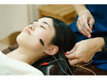 たたら鍼灸整骨院/電気を流す美容鍼