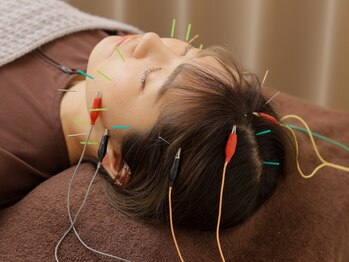 ハリベアー(HariBear)の写真/【丁寧なカウンセリング×技術力】美容鍼で顔のむくみ/肩コリ解消☆内側からケアすることでスッキリ感倍増!