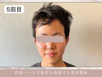 ほぐし屋 かすがい/5回目/小顔リフト+美姿勢整体