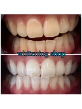 ホワイトニングショップ 倉敷店/