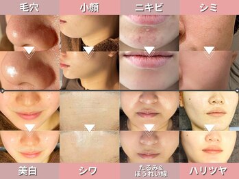 ルディラ 新宿店