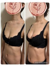 ハーグレイス 表参道外苑前(Her Grace)/バストアップ/バストケアBA