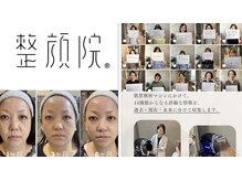 【小顔リフト】肌質改善 整顔院 経堂店