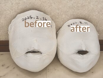 スゥ(Sod)/韓国式小顔リフト石膏コルギ