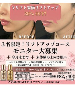 レモンスタジオ 秩父店/Vリフトコース