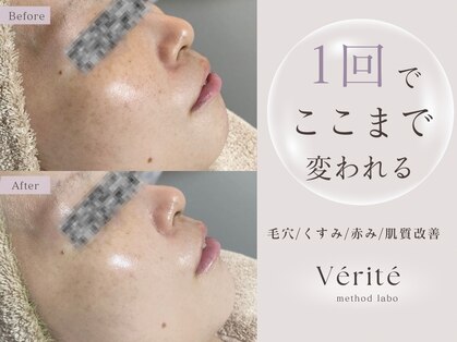 ヴェリテ(Verite)の写真