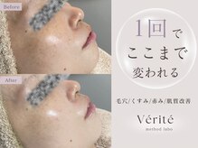 ヴェリテ(Verite)