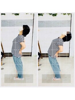 門前仲町イエティ鍼灸整骨院（旧：イエティ鍼灸整骨院）/ビフォーアフター♪