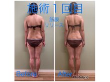 ビューティーフリー(Beauty-Free)の雰囲気（強圧筋膜リリース１２０分コース　ウエストラインもしっかり◎）