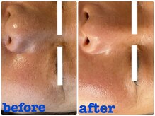 ナナラ(NANALA)/まずいらない物を出す！