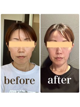 クリーム 京都店(Cream)/