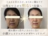 【小顔・リフトアップ】本格コルギ＋ヘッドスパ ￥16,000→￥9,900