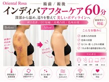 オリエンタルローザ 表参道(Oriental Rosa)/術前・術後のインディバケア重要