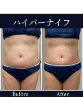 ハリルル 併設 GLケンタ鍼灸整骨院(HARILULU)/理想の自分に！