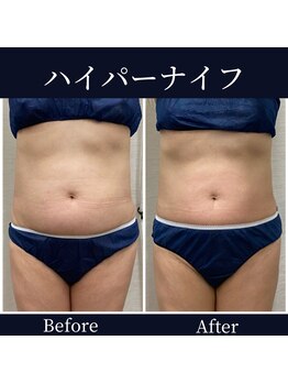 ハリルル 併設 GLケンタ鍼灸整骨院(HARILULU)/理想の自分に！