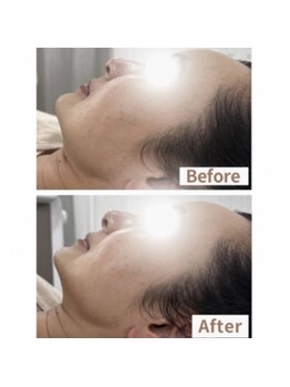 パルボヌール(parbonheur)/小顔フェイシャルマッサージ