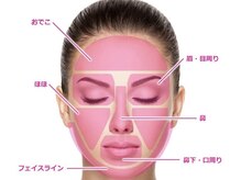 スリー(THREE)/都度払い脱毛【THREE】