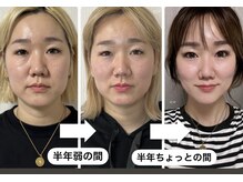 アリィ(Alii)の雰囲気（コツコツ１年で別人位に変わります）