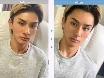 マユクリア 埼玉大宮店/美眉B/A [眉毛/眉毛サロン/大宮]