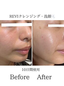 ルリエベル(Relier Belle)/毎日のスキンケア選びも大切