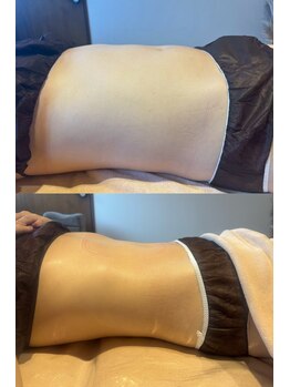 カーム(CALM.)/３ヶ月集中ダイエット