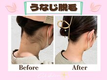 ヴィ シェーン(Vi Schoen)/うなじBefore／After【W型】