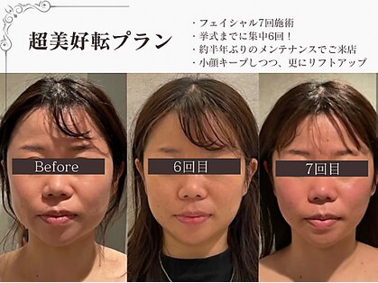 ラブミー 渋谷本店(LoveMe)の写真