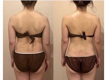 ワイグレイス(Y.GRACE)/ヴィーナスディーバ（4D痩身）