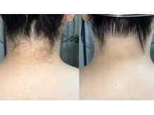 リュール(Lueur)の雰囲気（お電話でのお問い合わせ大歓迎です！）