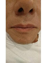 グラジュス(grazus)/つるつる