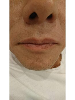 グラジュス(grazus)/つるつる