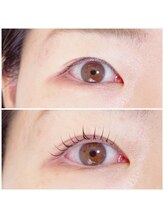 ブリーズ(Breathe)/ラッシュリフト