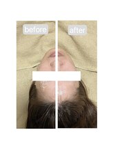 トランク(Trunk)/エアバリ♪before→after