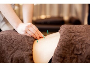 六花鍼灸整骨院 博多駅前店/肩こりふ・ぎっくりに★部分鍼