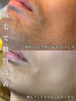 サロン ド マキ(Salon de Maki)/髭剃り卒業で時短☆美肌☆モテ♪