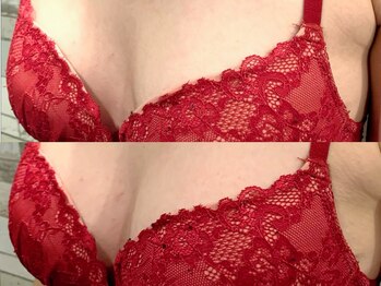 クラウン 心斎橋店(CROWN)/★バストケア★