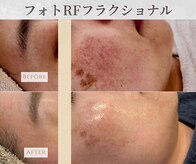 ソワン(Soin)