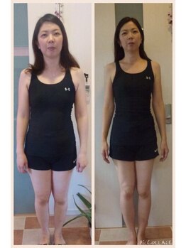 カパリリ/ビフォーアフター写真