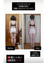 ステラ(Stella)/【痩身】ボディリンパマッサージ