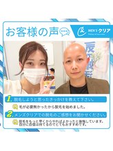 メンズクリア 福岡天神店/【メンズクリア】お客様の施術例