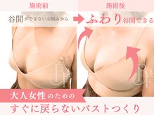 ベルフルール/離れ・削げバストに/熊本/南熊本