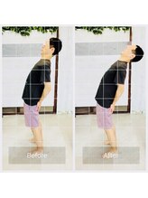 門前仲町イエティ鍼灸整骨院（旧：イエティ鍼灸整骨院）/ビフォーアフター♪