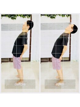 門前仲町イエティ鍼灸整骨院（旧：イエティ鍼灸整骨院）/ビフォーアフター♪